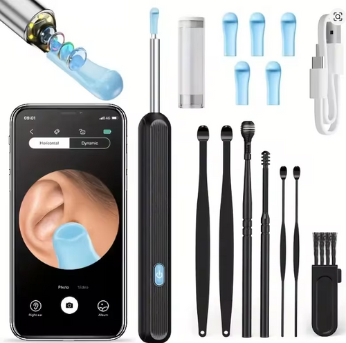 Inteligentna Kamera do Czyszczenia Uszu HD – Podgląd w Telefonie