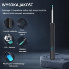 Inteligentna Kamera do Czyszczenia Uszu HD – Podgląd w Telefonie